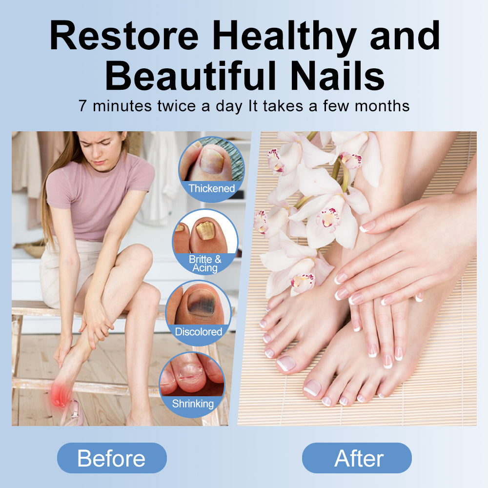 LED Light Nail Treatment